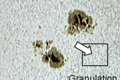 granulation_20090701_1557622907